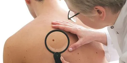 Sok mol a test - hogy mit jelent, az okok a gyermekek és felnőttek, veszélyes változások