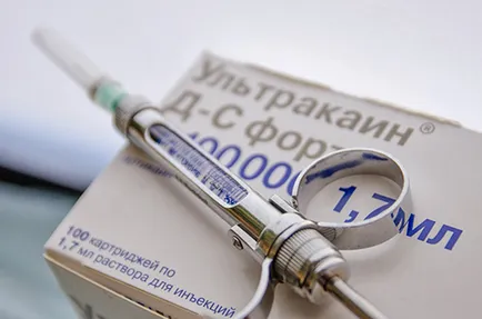 A helyi érzéstelenítők a fogászatban besorolás generáció