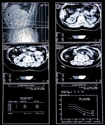 MRI a has - a készítmény és a költségek MRI a belső szervek a hasüregbe MRI a has - a készítmény és a költségek MRI a belső szervek a hasüregbe