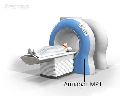 hasi MRI, amely megmutatja, hogyan kell elkészíteni (Magnetic Resonance Imaging utal) MRI a has, amely megmutatja, hogyan kell elkészíteni