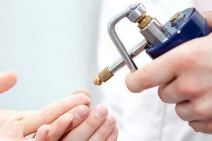 Lehetséges, hogy távolítsa el papilloma a test és attól, hogy az ehhez szükséges Lehetséges, hogy távolítsa el papilloma a test és attól, hogy az ehhez szükséges
