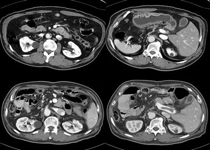 MRI A hasüreg felkészülés egy tanulmány, amely azt mutatja, az ár, vélemények, fotók (hasi) hasi MRI felkészülés egy tanulmány, amely azt mutatja, az ár, vélemények, fotók