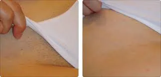 Hírek MD sürgetik a nők nem borotválkozik a bikinivonal (borotválás) Hírek MD sürgetik a nők nem borotválkozik A bikinivonal