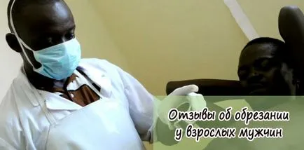 Férfi körülmetélés vélemény a műtét után