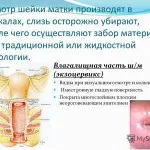 Parabulbarnom hogy