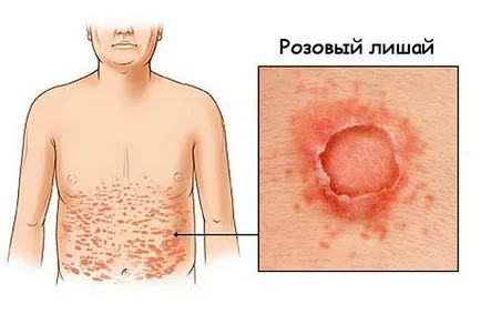 Az első jelei megfosztva egy személy képe és kezelések