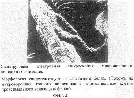Parabulbarno ezt - és parabulbarnom 500 mg, csecsemő alvás (parabulbarno szubkonjunktivális injekció) Parabulbarno azt - és a parabulbarno beadása 500 mg, baba alvás