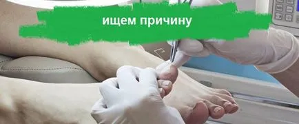 Miért megfeketedik a köröm nőknél okoz, hogyan kell gyógyítani (valamilyen okból) Miért megfeketedik a köröm nőknél okoz, hogyan kell gyógyítani