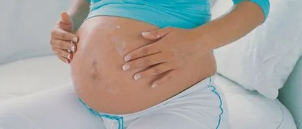 Miért viszkető hason terhesség alatt a korai és késői szakaszában (terhesség) Miért viszkető hason terhesség alatt a korai és késői szakaszában