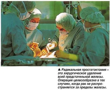 Prostatitis fejpénz diagnózis