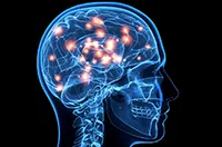 Maradék encephalopathia gyermekek - mi ez (encephalopathia) Maradék encephalopathia gyermekek - mi ez