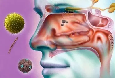 Rhinitis gyermekek tünetei és kezelése, az okok (kezelés) Rhinitis gyermekek tünetei és kezelése, okai