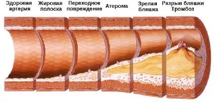 láb vérerek (alsó végtag) mik a betegségek, a tünetek és a kezelés (a vérerek) láb vérerek (alsó végtag) mik a betegségek, tünetek és a kezelés