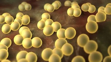 Aureus gyermekek mind az elküldött és hogyan fog az arany felnőtt (át) Aureus gyermekek mind az elküldött és hogyan fog az arany felnőtt