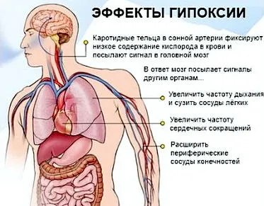 Nehéz lélegezni, a levegő nem elég ok, hogy kell csinálni (levegő) Nehéz lélegezni, a levegő nem elég ok, mit kell tenni
