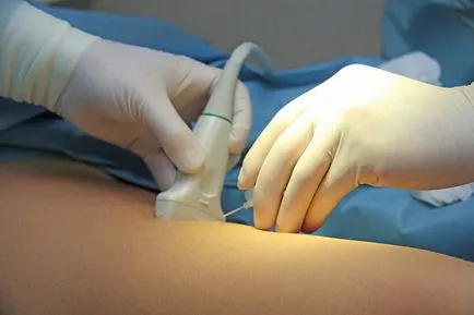 Vénás trombózis tünetek, panaszok re, mi történik, és hogyan kell kezelni