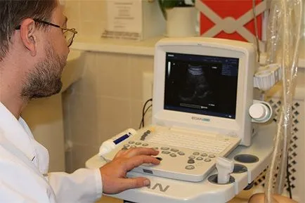 Uzi például nyirokcsomókban végezzük, és amely feltárja patológia (patológia) Uzi a nyirokcsomók végzik, és mi a patológia kiderül
