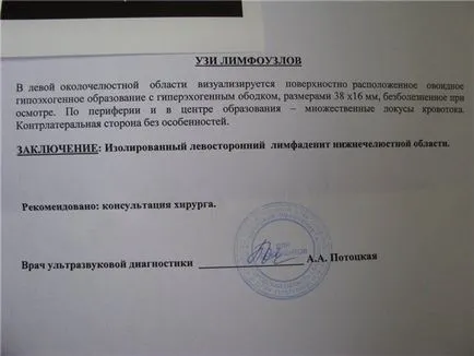 Uzi nyirokcsomók a nyak átirat - az élet Uzi (nyirokcsomók) Uzi nyirokcsomók a nyak átirat - Uzi élet