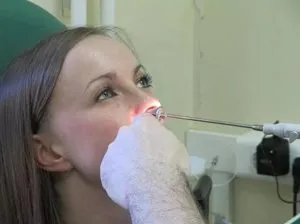 Típusai és tünetei staphylococcus diagnózis és kezelési módszerek, valamint azt, hogy milyen veszélyes lehet, és hogyan
