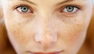 Mely élelmiszerekben található melanin