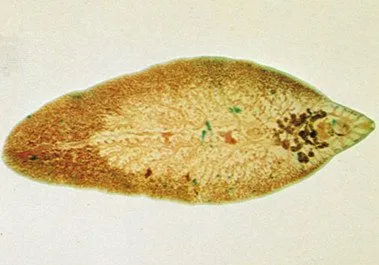Mi magyarázza, hogyan lehet átvinni a bakteriális staphylococcus - szerencse (Ez az oka) Mi magyarázza, hogyan lehet átvinni a bakteriális staphylococcus - egészséges
