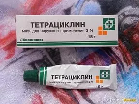 Árpa a gyermek, mint kezelni receptek és ajánlások (kezelésére) Árpa a gyermek, mint kezelni receptek és ajánlások