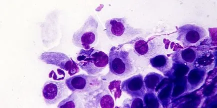 Chlamydia, hogy van, a típusok, okok, tünetek, kezelés, megelőzés (faj) Chlamydia, hogy van, a típusok, okok, tünetek, kezelés, megelőzés