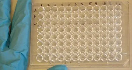 Chlamydia, hogy van, a típusok, okok, tünetek, kezelés, megelőzés Chlamydia, hogy van, a típusok, okok, tünetek, kezelés, megelőzés