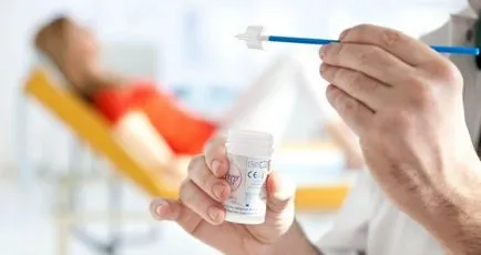Chlamydia, hogy van, a típusok, okok, tünetek, kezelés, megelőzés (Chlamydia) Chlamydia, hogy van, a típusok, okok, tünetek, kezelés, megelőzés