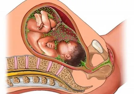 A Chlamydia a nők és a férfiak tünetei, diagnózisa, kezelések, oslozhenenija chlamydia (kezelés) Chlamydia női és férfi tünetei, diagnózisa, kezelések, oslozhenenija chlamydia