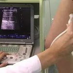 Érrendszeri betegségek láb tünetek és a kezelés (kezelés) Vaszkuláris betegségének lábak tünetek és kezelés