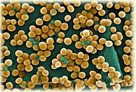 Staphylococcus aureus tünetek és a kezelés, amint arról a Staphylococcus fertőzés,