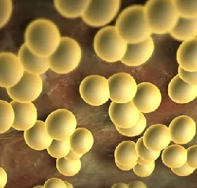 Staphylococcus aureus Tünetek, kezelés, fotók Staphylococcus aureus Tünetek, kezelés, fotók
