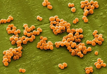 Staphylococcus aureus gyermekeknél a tünetek, mértékét, hatásait S. aureus