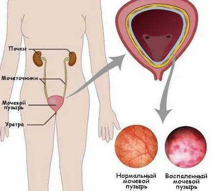 Viszketés menopauza a hüvelyben kezelést népi jogorvoslat