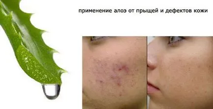Aloe arc - maszkok receptek otthon, használatát és előnyeit (maszkok) Aloe arc - maszkok receptek otthon, a használat és a javára