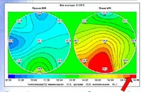 Egyesület mikrohullámú radiometria mi RTM-diagnózis