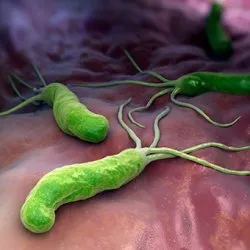 Helicobacter pylori tünetei és kezelése hagyományos és a népi gyógyászat (kezelés) Helicobacter pylori tünetei és kezelése hagyományos és népi jogorvoslati