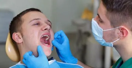 Hurt tettem fogszabályozó a fogait eljárás leírása