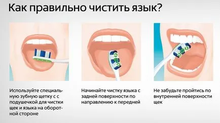 A tiszta nyelv, és hogyan kell csinálni a helyes tippek és eszközök (jobb egészségügyi) A tiszta nyelv, és hogyan kell csinálni a helyes tippek és eszközök