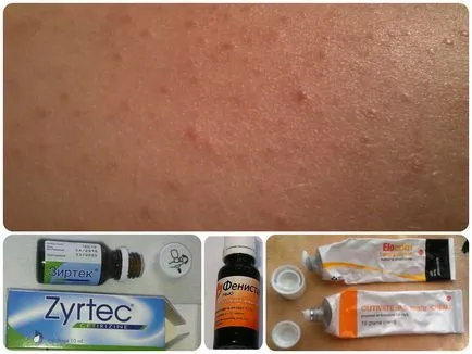 Viszkető test, és találja meg az okát hólyagok és-treat, növedékek a bőrön