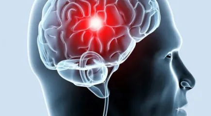 Mik az első jelei a stroke és a lehetséges következmények