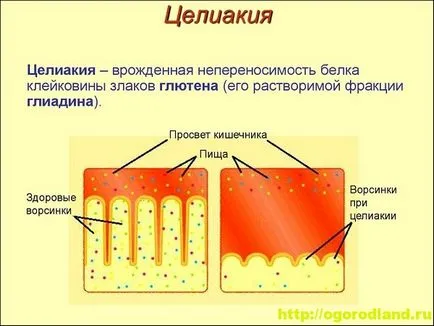 Diagnosztizálása, kezelése és megelőzése betegségek „téma