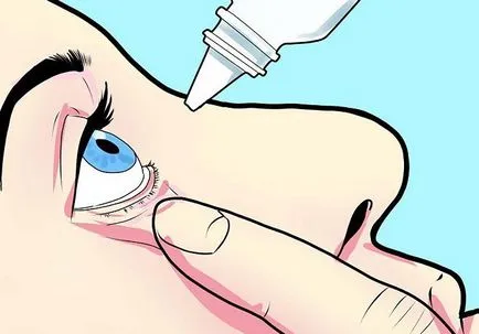 Árpa az alsó szemhéj fejlesztése és gyulladás kezelésére (árpa) Árpa az alsó szemhéj a fejlődés és a gyulladások kezelésére