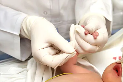 Diagnózis a HIV gyors vizsgálati módszerek