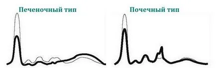 Elektroforézis vérfehérjék