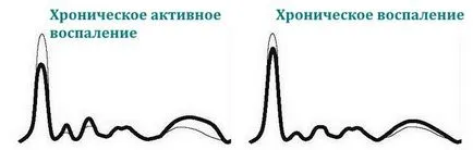 Elektroforézis vérfehérjék