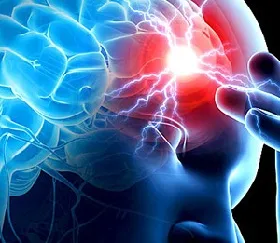 Stroke tüneteit, a tünetek a nők és a férfiak, a hatásait