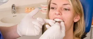 Malocclusion Felnőttek nélkül zárójelek