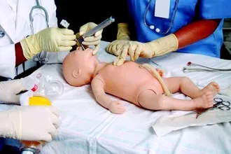 Intubálnak - gépek és alkalmazási javallatok (okozhatja) Intubálnak - gépek és alkalmazási javallatok